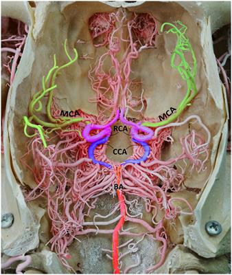 Mapping the branching pattern of the middle cerebral artery in the camel (Camelus dromedarius): a comprehensive anatomical analysis